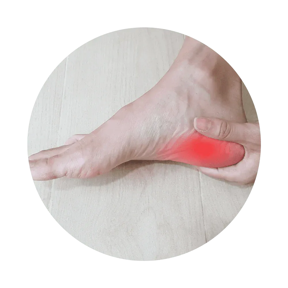 Plantar Fasciitis